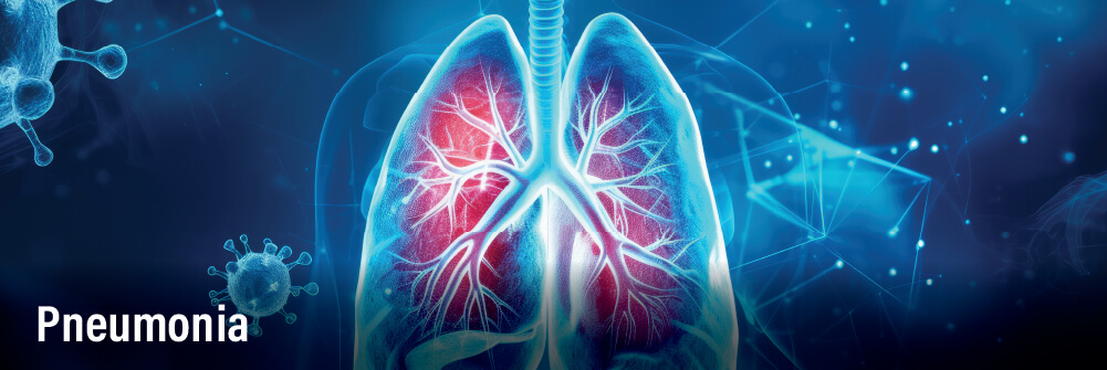 Image depicting pneumonia